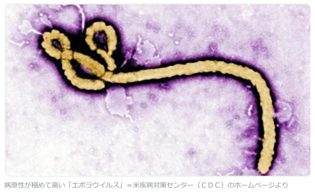 エボラ出血熱ウイルス